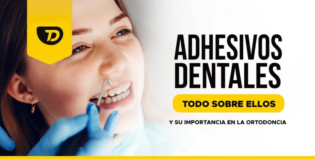 Adhesivos Dentales: Todo sobre ellos y su importancia en la ortodoncia