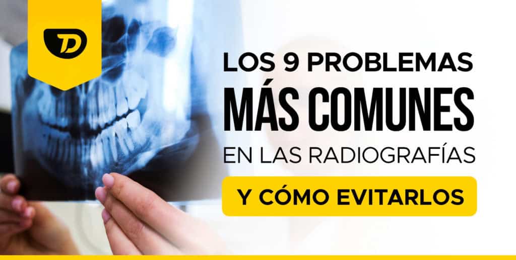 Radiografías Dentales: Los problemas más comunes y cómo evitarlos