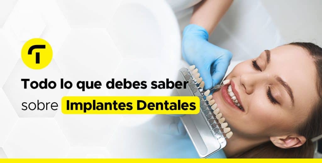 Implantes dentales: 7 claves para una colocación efectiva