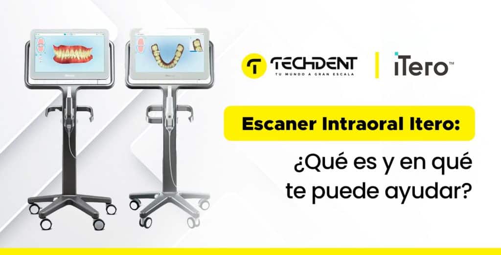 Escáner 3D iTero: Ventajas y Beneficios