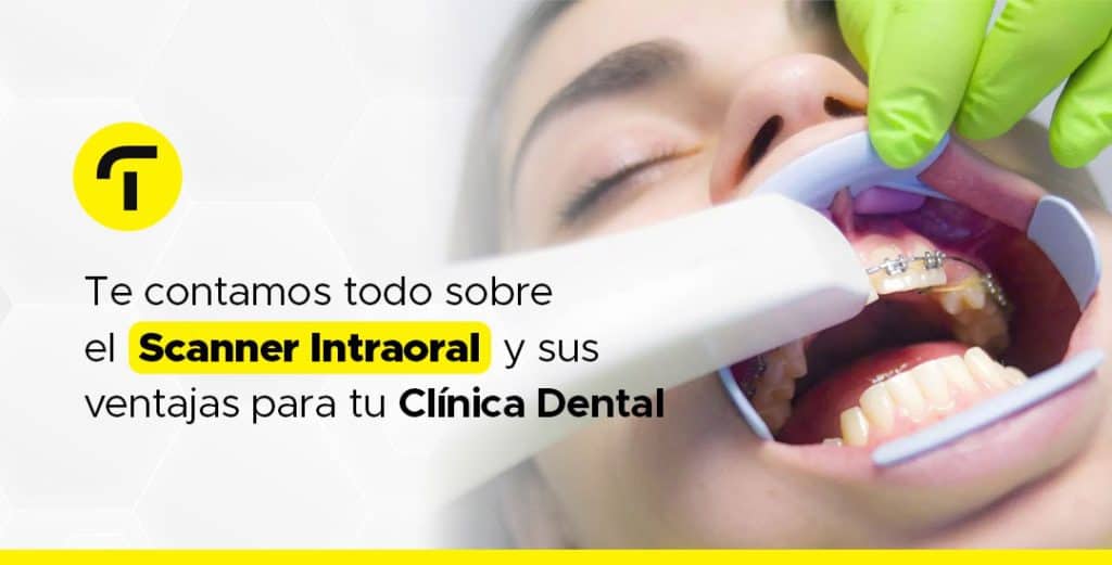 Scanner Intraoral: Ventajas para Clínicas Dentales