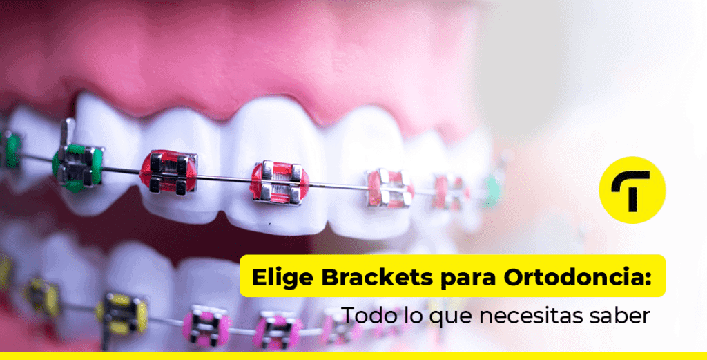 Brackets para Ortodoncia: Todo lo que necesitas saber