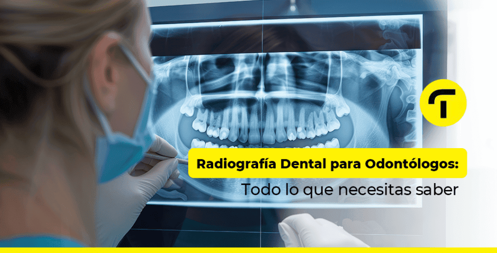 Radiografía Dental para Odontólogos: Todo lo que necesitas saber