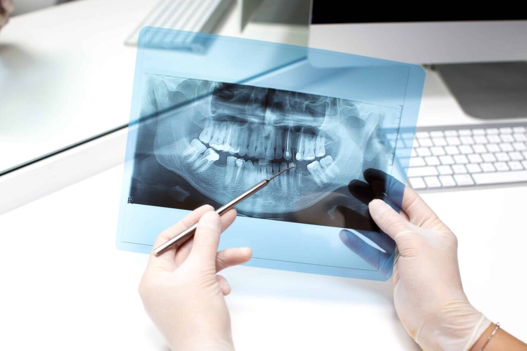 radiografía dental
