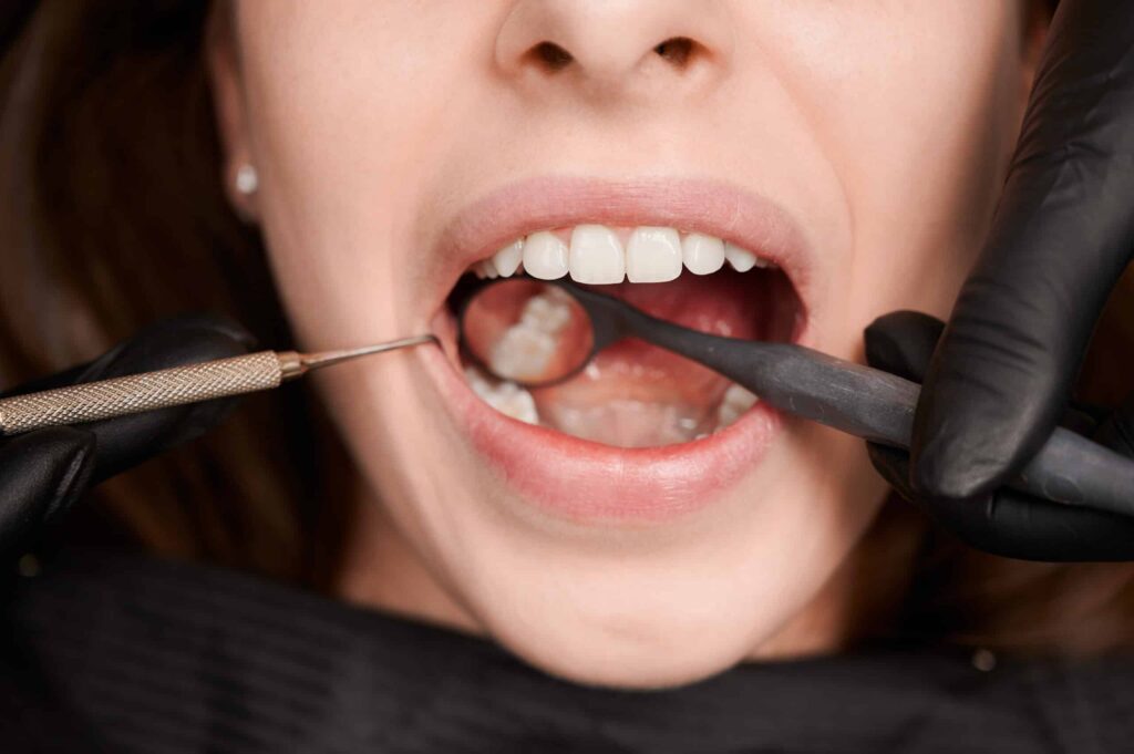 restauraciones dentales