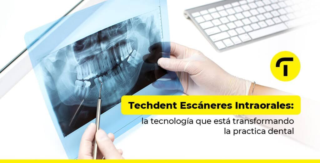 escaner intraoral