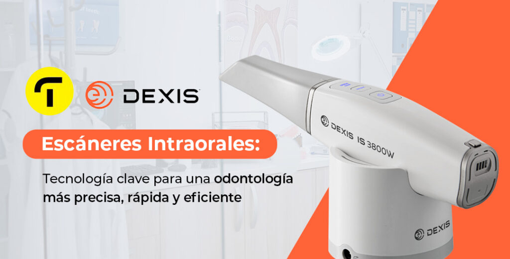 Escáneres intraorales