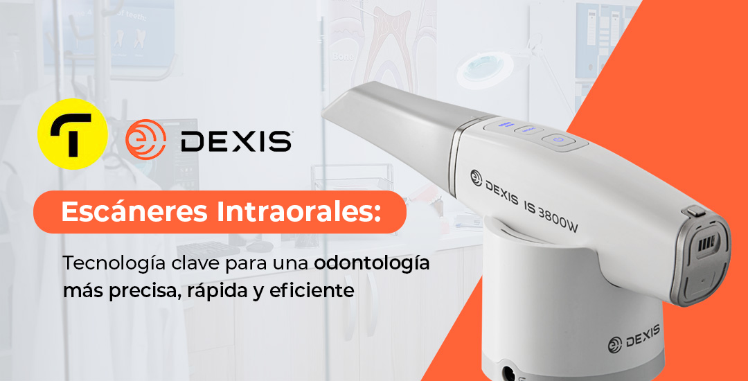 Escáneres intraorales