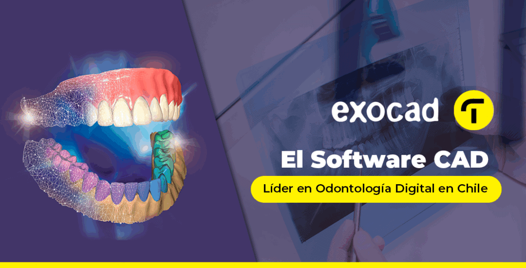 Exocad